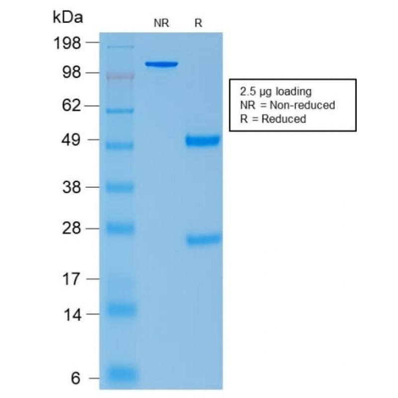 Biotium BNC882296-100, ACTH (Adrenocorticotrophic Hormone) (Pituitary Marker) (rCLIP/1407), CF488A conjugate, 0.1mg/mL