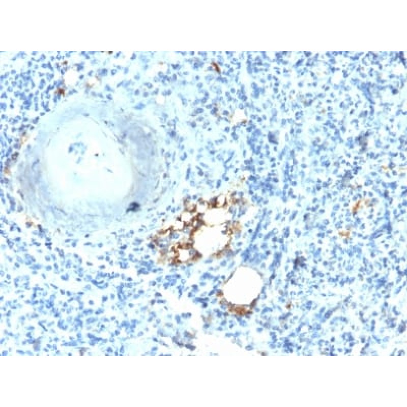 TRAcP (Tartrate-Resistant Acid Phosphatase) (Hairy Cell Leukemia Marker) (ACP5/2336R), CF488A conjugate, 0.1mg/mL