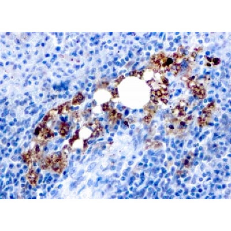 TRAcP (Tartrate-Resistant Acid Phosphatase) (Hairy Cell Leukemia Marker) (rACP5/1070), CF488A conjugate, 0.1mg/mL