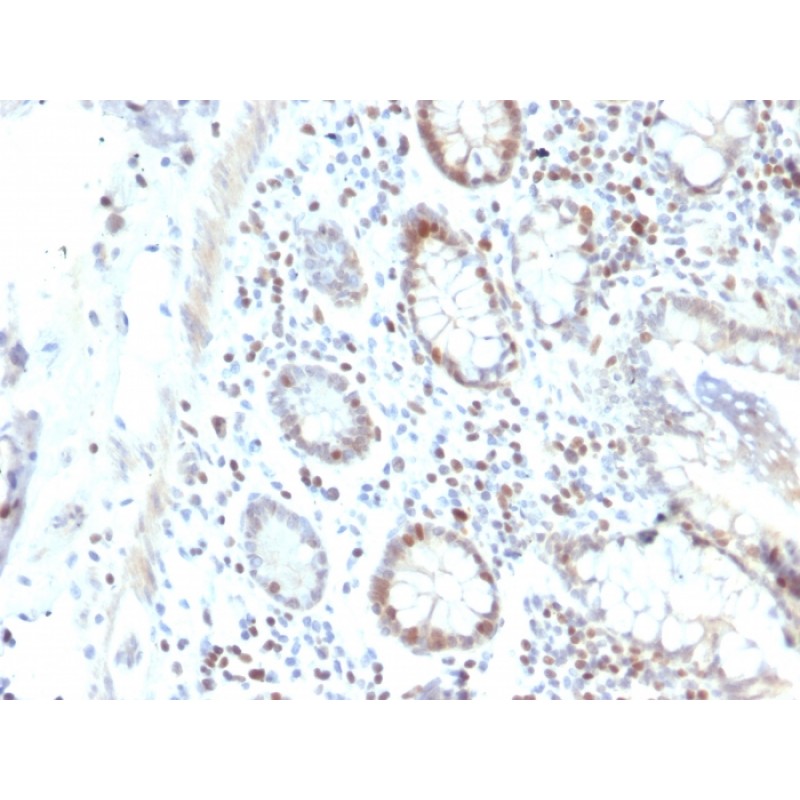 RAD51 (Prognostic and Response to Chemotherapy Marker)(RAD51/2702), CF488A conjugate, 0.1mg/mL