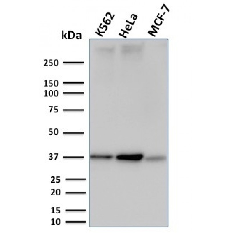 RAD51 (Prognostic and Response to Chemotherapy Marker)(RAD51/2753), CF488A conjugate, 0.1mg/mL