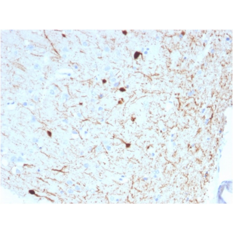 Biotium BNC882786-100, Calretinin / Calbindin 2 (Mesothelioma Marker)(CALB2/2786), CF488A conjugate, 0.1mg/mL