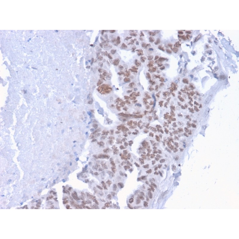 CHD4(3F2/4), CF488A conjugate, 0.1mg/mL