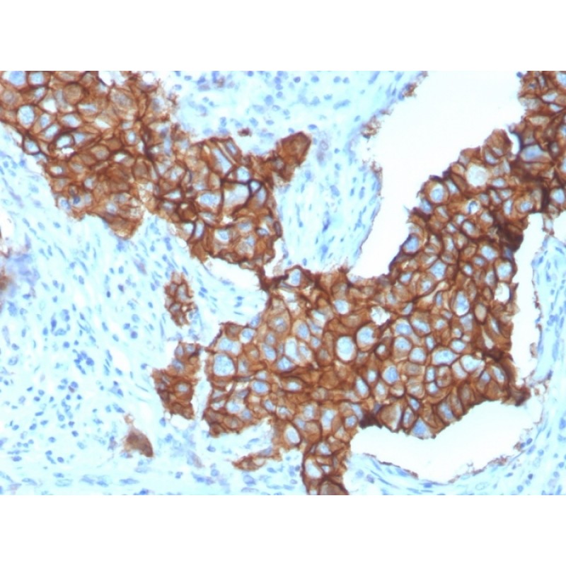 HER-2 / c-erbB-2 / neu / CD340(ERBB2/3257), CF488A conjugate, 0.1mg/mL