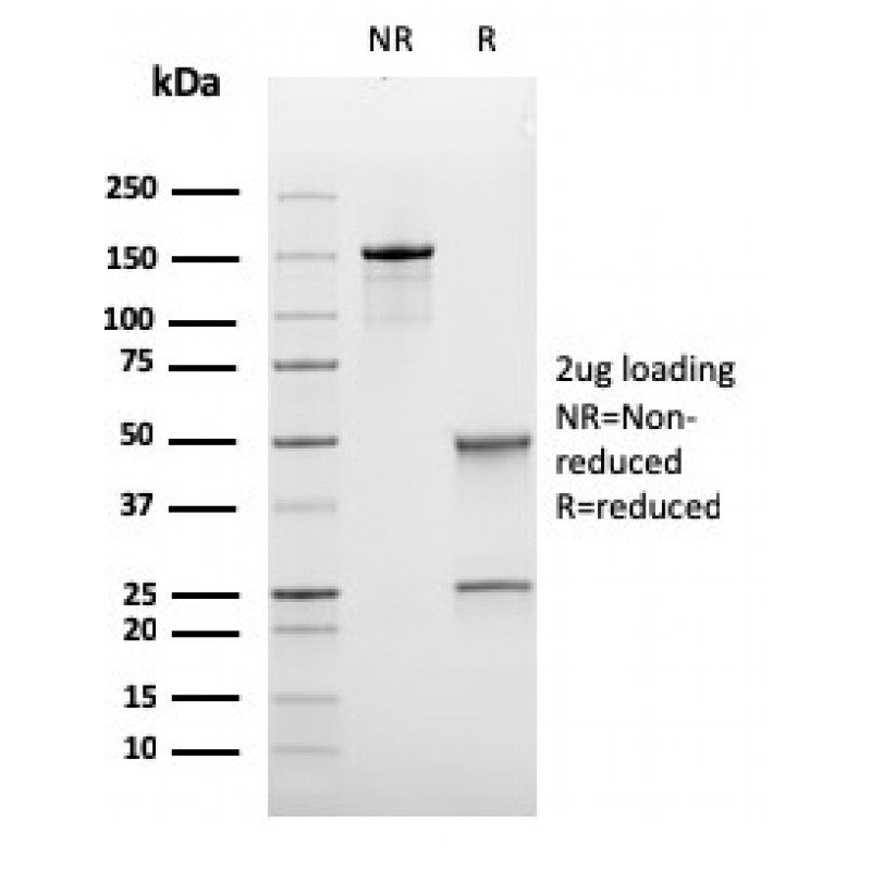 Biotium BNC883433-100, Bcl-6 (Follicular Lymphoma Marker)(rBCL6/1475), CF488A conjugate, 0.1mg/mL