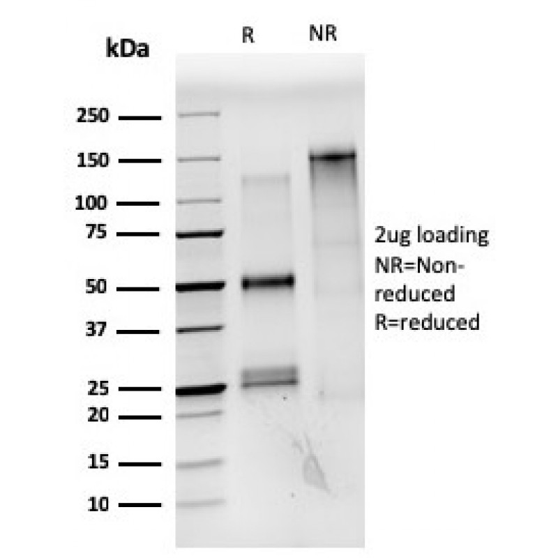 Estrogen Receptor, alpha (Marker of Estrogen Dependence)(ESR1/3559), CF488A conjugate, 0.1mg/mL