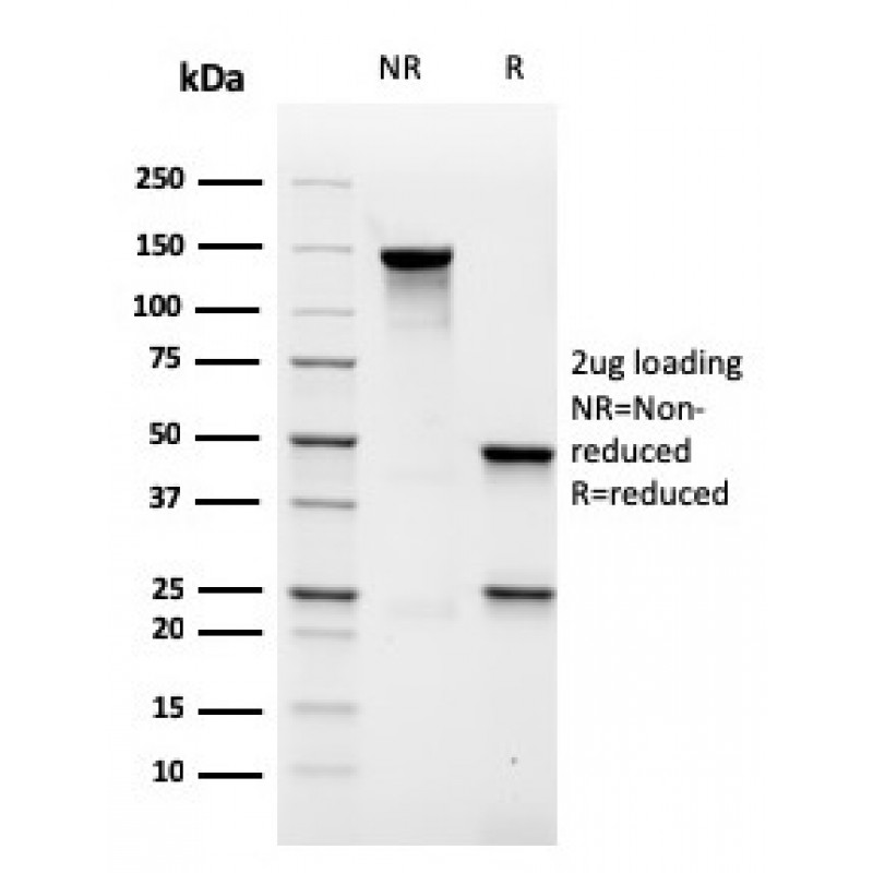 MALT1 (MALT-Lymphoma Marker)(rMT1/410), CF488A conjugate, 0.1mg/mL