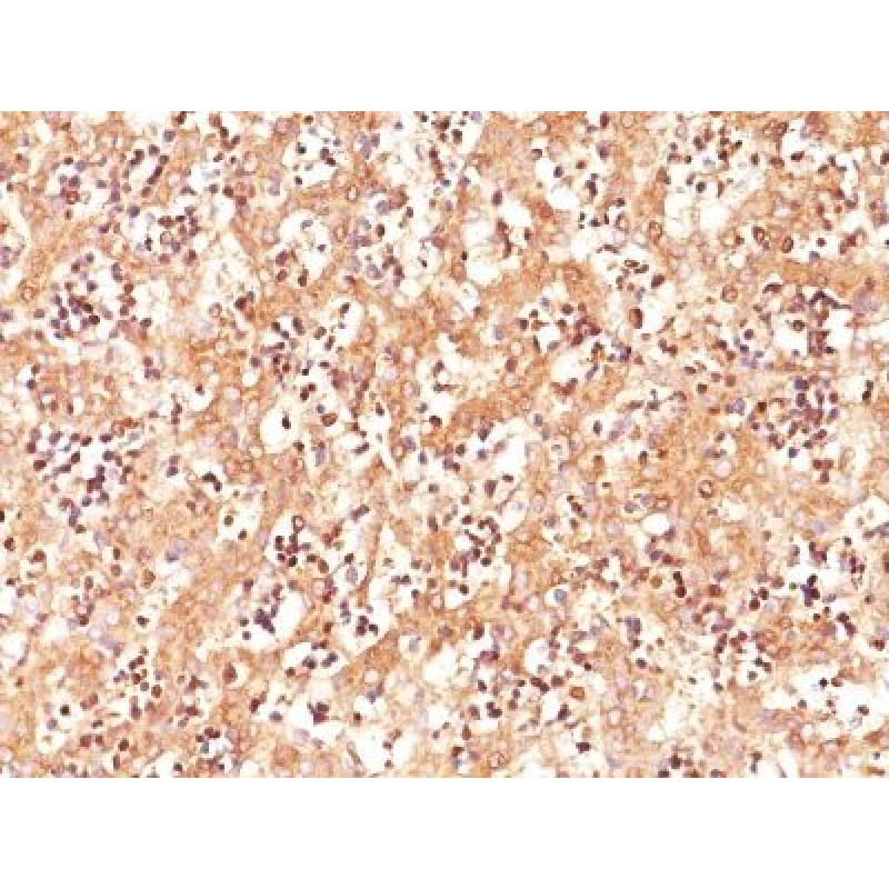 AFP (Alpha Fetoprotein)(C3), CF594 conjugate, 0.1mg/mL