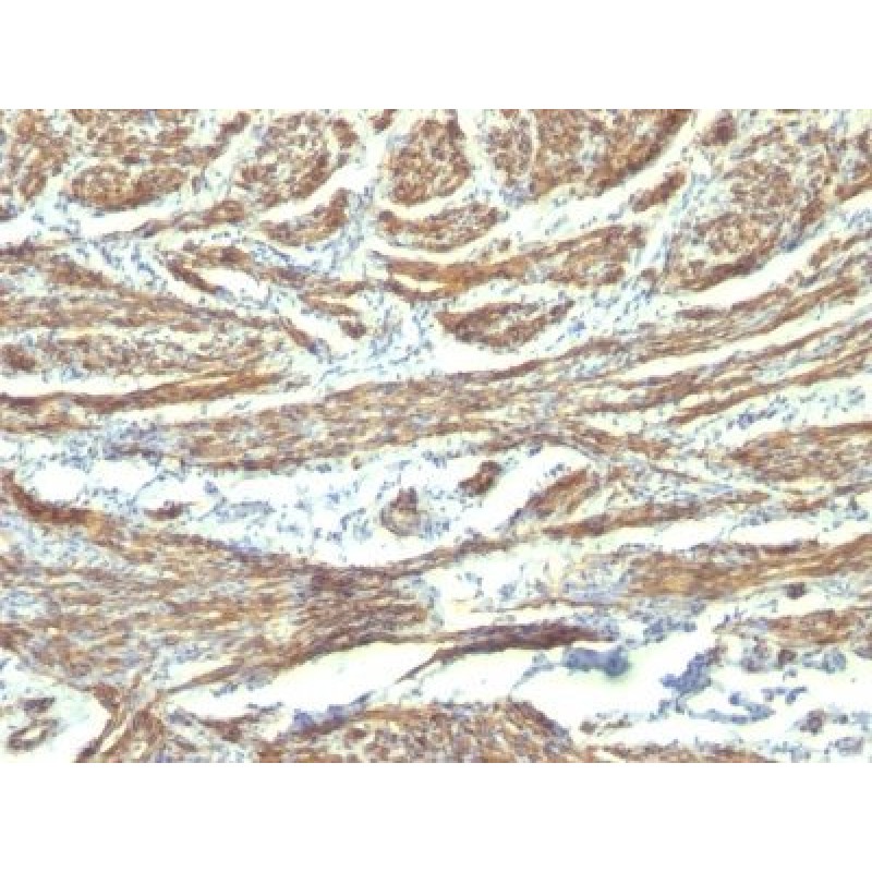 Caldesmon, HMW (h-Caldesmon)(CALD1/820 + h-CALD), CF594 conjugate, 0.1mg/mL