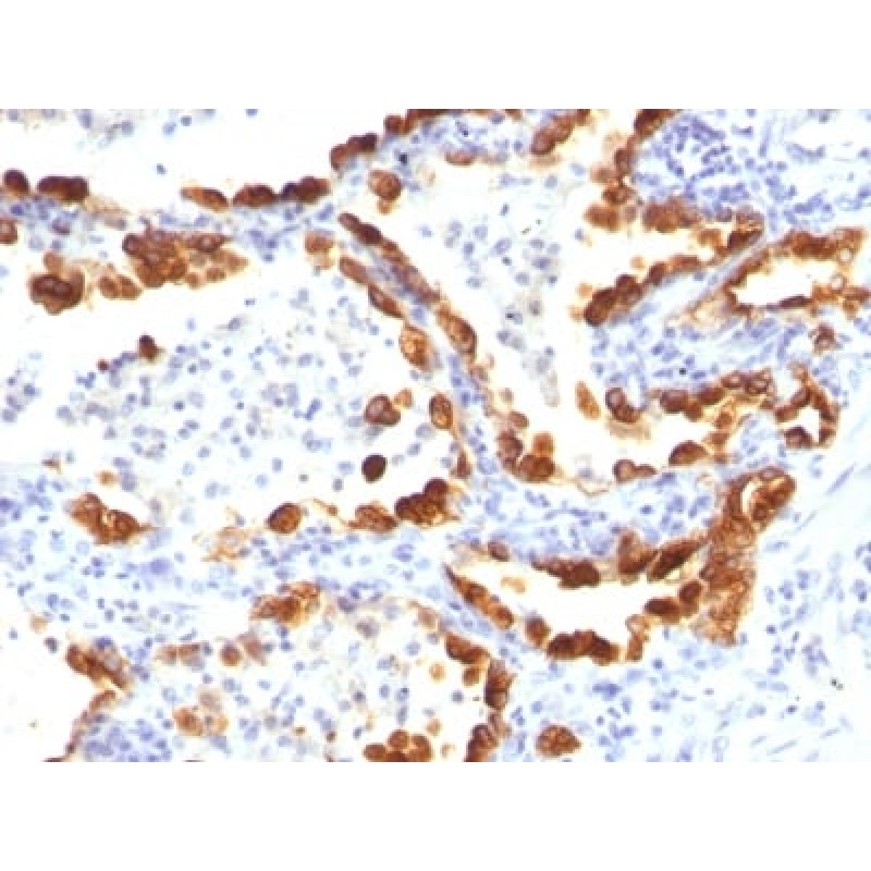 Cytokeratin 18(KRT18/835), CF594 conjugate, 0.1mg/mL
