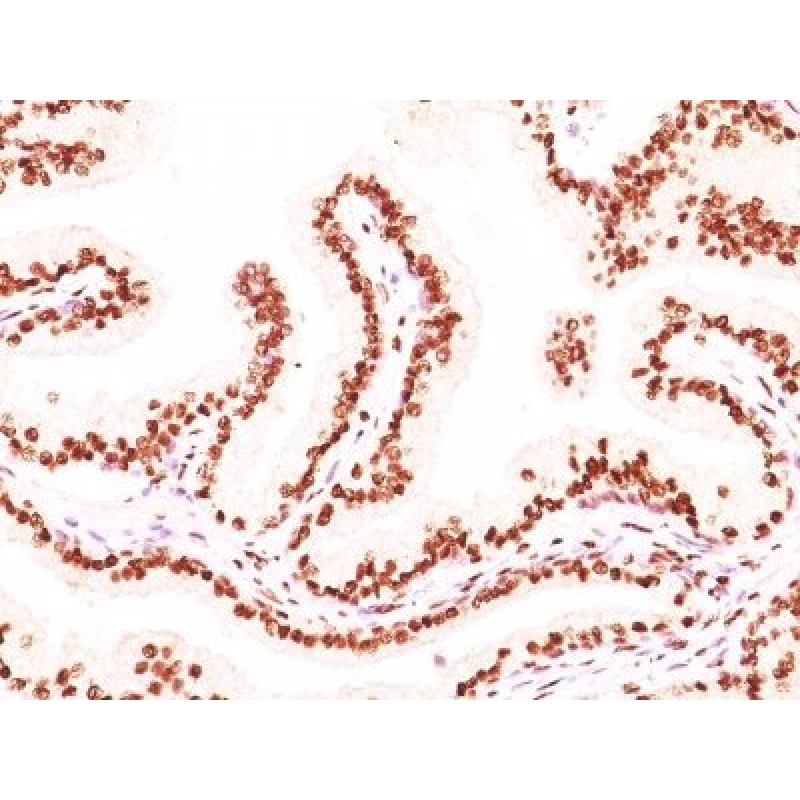 Androgen Receptor(AR441 + DHTR/882), CF594 conjugate, 0.1mg/mL