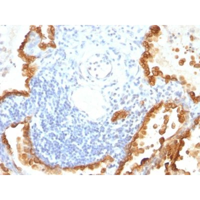Cytokeratin 8/18(KRT8/803 + KRT18/835), CF594 conjugate, 0.1mg/mL