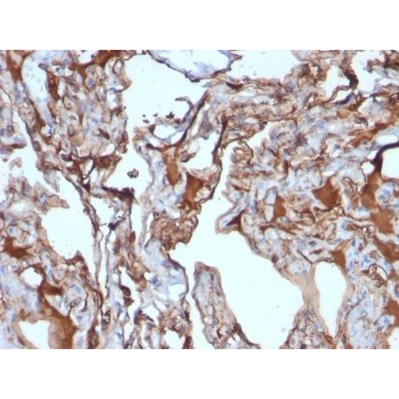 MUC18 / Mucin 18 / CD146(MUC18/1130), CF594 conjugate, 0.1mg/mL