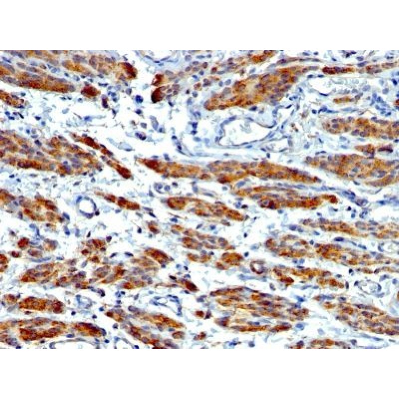 Myosin, Smooth Muscle Heavy Chain(MYH11/923 + SMMS-1), CF594 conjugate, 0.1mg/mL