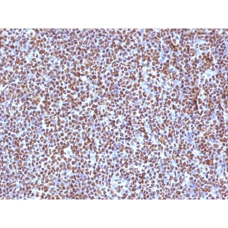 ALK (Anaplastic Lymphoma Kinase) / CD246(ALK/1504), CF594 conjugate, 0.1mg/mL