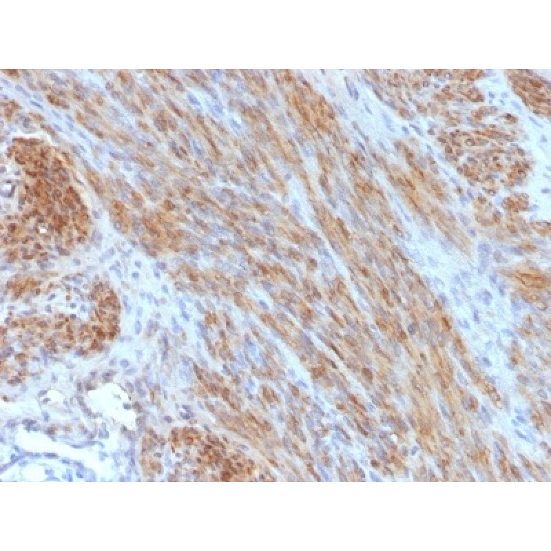 Desmin (Muscle Cell Marker) (DES/1711), CF594 conjugate, 0.1mg/mL
