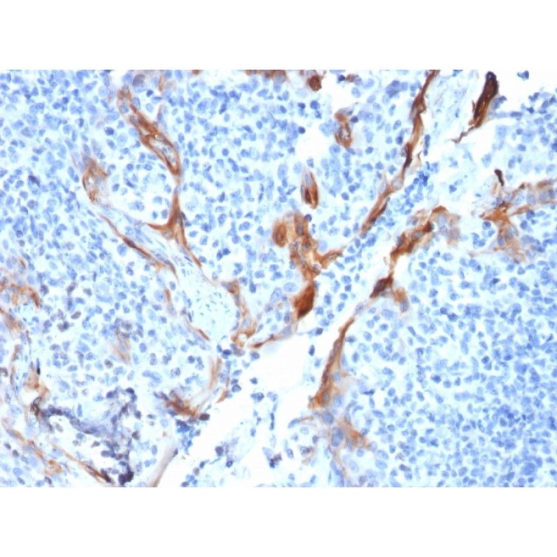 Cytokeratin 16 (KRT16) (Suprabasal Keratinocyte Marker)(KRT16/1714), CF594 conjugate, 0.1mg/mL