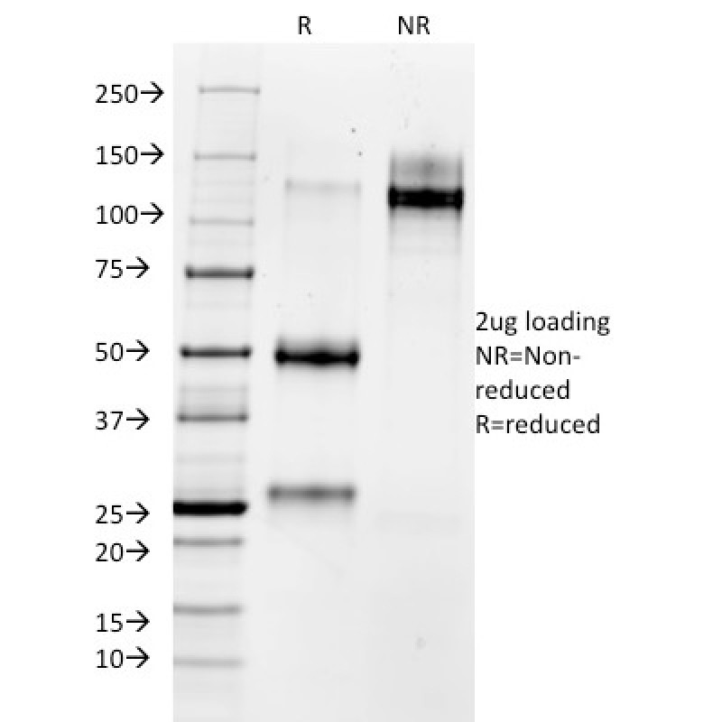 MMP3 (Marker of Metastasis and Rheumatoid Arthritis)(MMP3/1730), CF594 conjugate, 0.1mg/mL