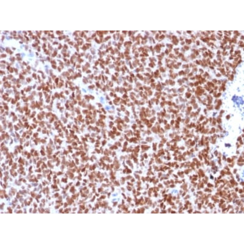 NKX2.2 (Neuroendocrine & Ewing s Sarcoma Marker) (rNX2/294), CF594 conjugate, 0.1mg/mL