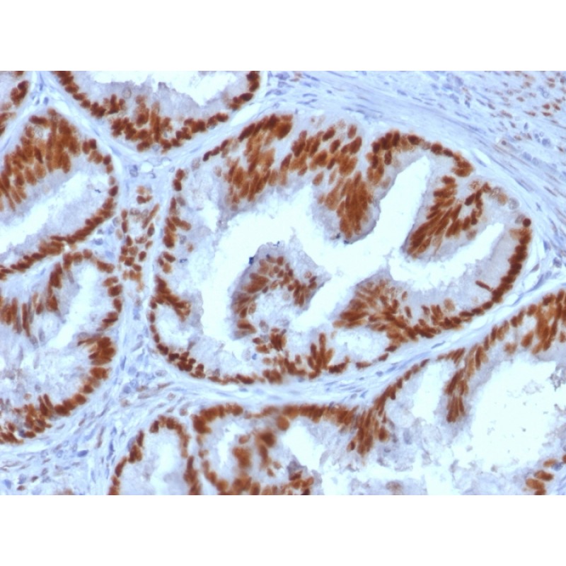 Estrogen Receptor, alpha (Marker of Estrogen Dependence) (ESR1/1935), CF594 conjugate, 0.1mg/mL