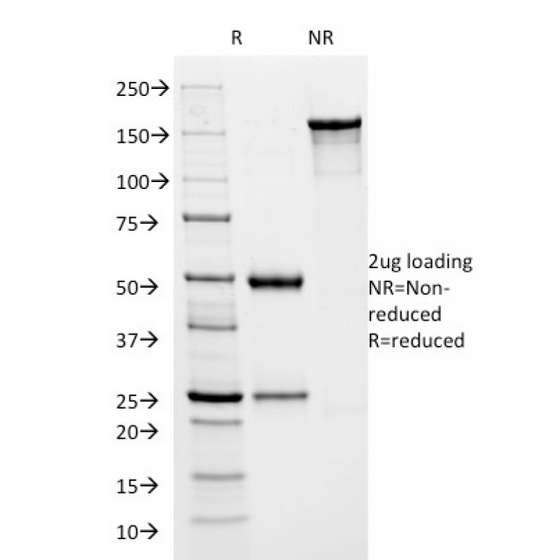 HSV1 (Herpes Simplex Virus Type I) ICP8(HSVI/2045), CF594 conjugate, 0.1mg/mL