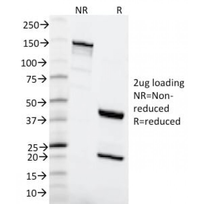 MSH6 (DNA Mismatch Repair Protein) (MSH6/2111), CF594 conjugate, 0.1mg/mL
