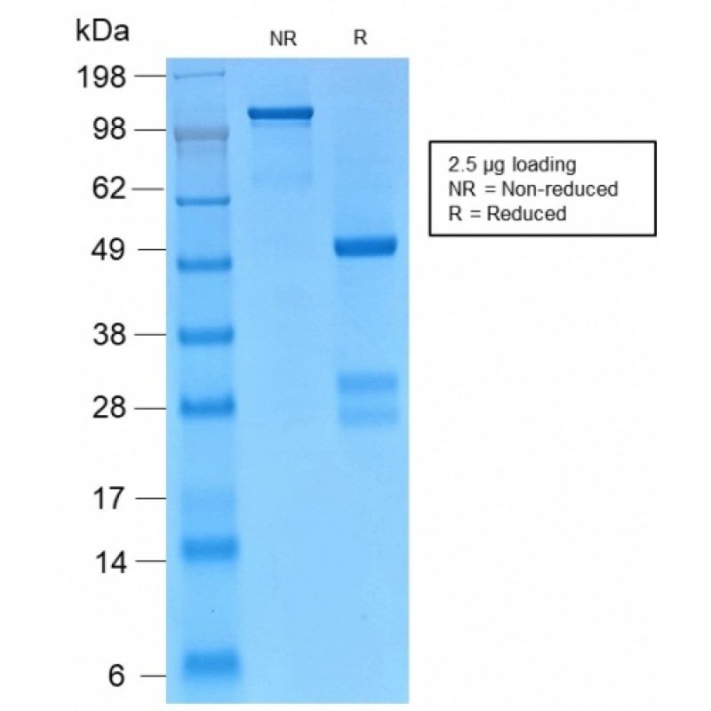 Biotium BNC942155-100, Catenin, gamma (Cardiomyocyte Marker)(CTNG/2155R), CF594 conjugate, 0.1mg/mL