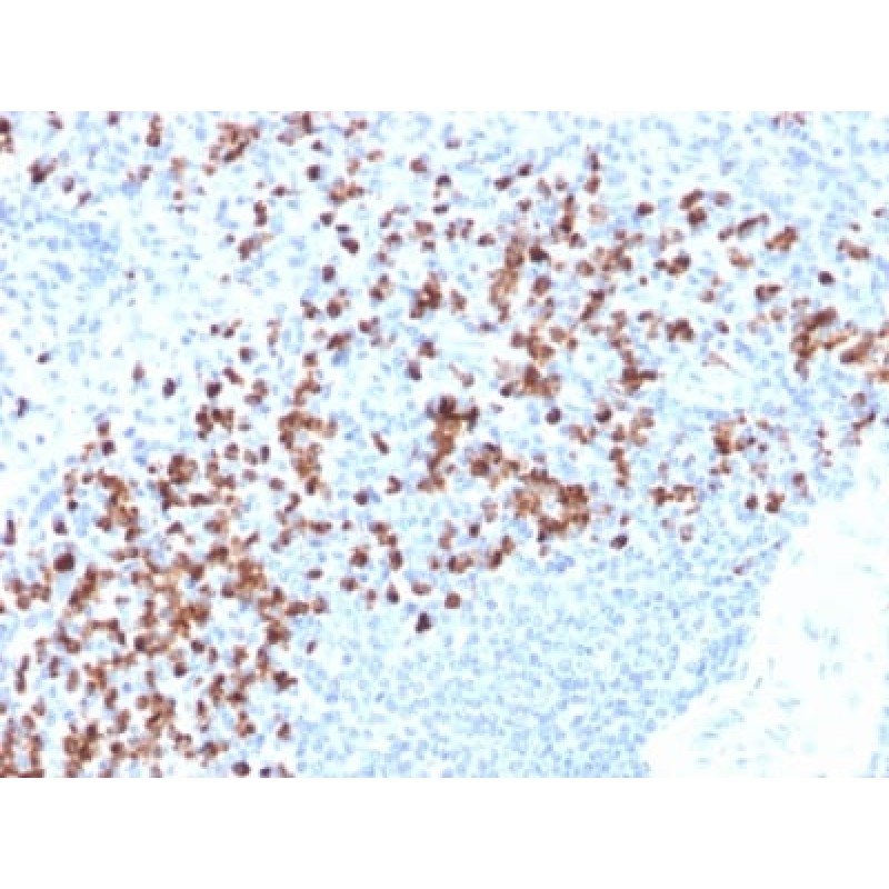 MMP9 (rMMP9/1769), CF594 conjugate, 0.1mg/mL