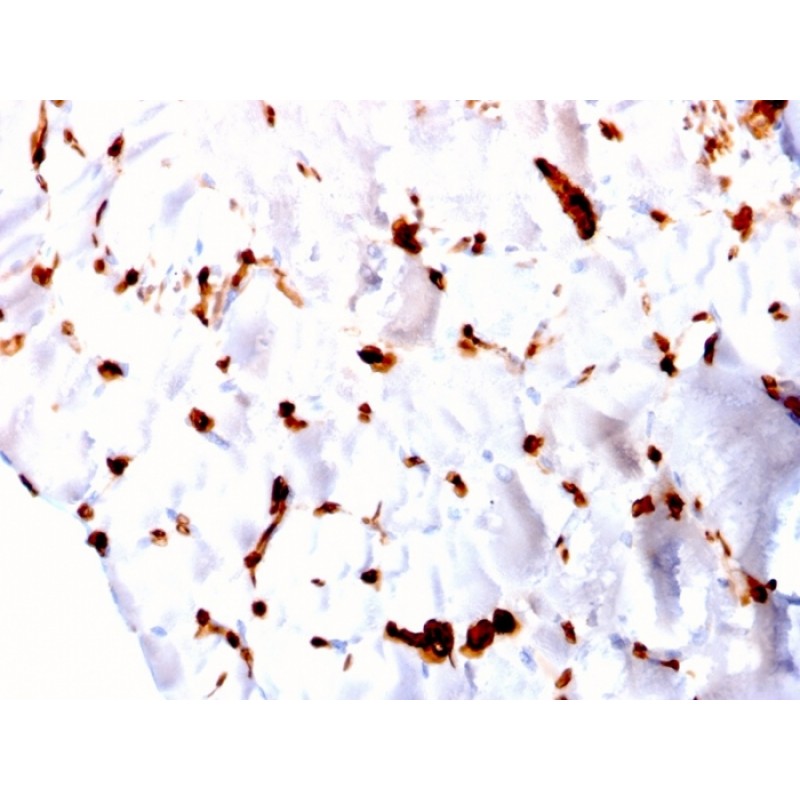FABP5 (Marker of Metastatic Potential in Colorectal Cancer)(CPTC-FABP5-3), CF594 conjugate, 0.1mg/mL