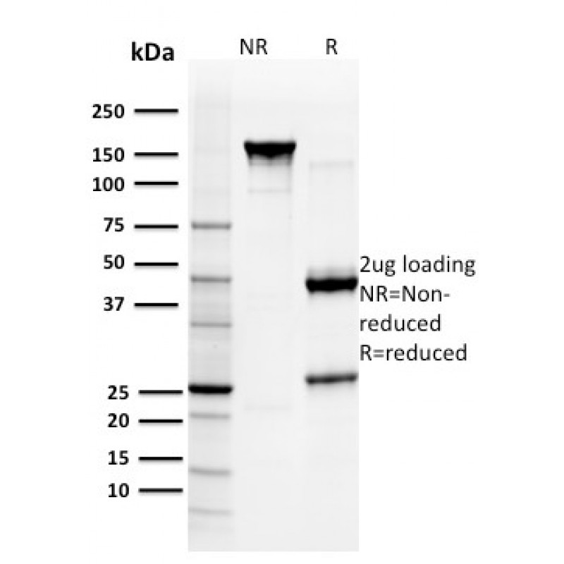 Glutathione S-Transferase Mu3 (GSTM3)(CPTC-GSTMu3-1), CF594 conjugate, 0.1mg/mL