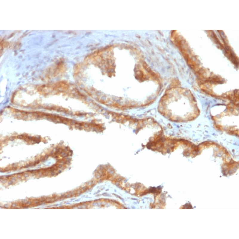 YBX1 / Y-box Binding Protein 1 / YB-1 (Tumor Biomarker)(rYBX1/2430), CF594 conjugate, 0.1mg/mL
