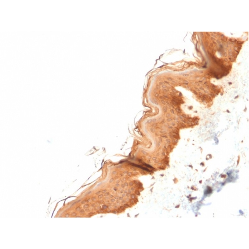 Cytokeratin 4 (KRT4)(KRT4/2804), CF594 conjugate, 0.1mg/mL