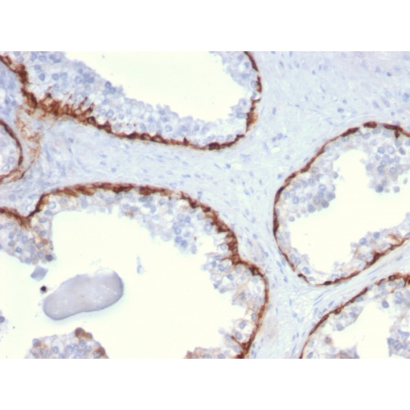 Cytokeratin 15 (Esophageal Squamous Cell Carcinoma Marker)(KRT15/2959), CF594 conjugate, 0.1mg/mL