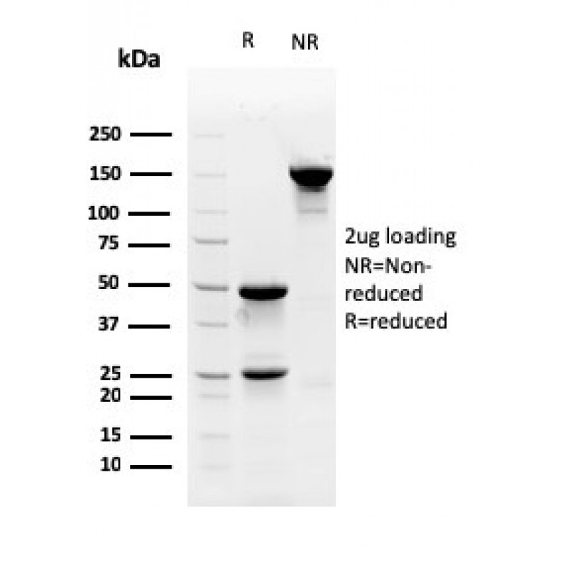 Myofibroblast Marker(PR 2D3), CF594 conjugate, 0.1mg/mL