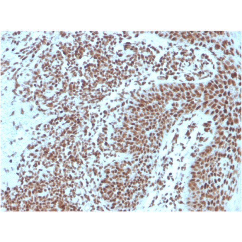 Nucleophosmin (Acute Myeloid Leukemia Marker)(NPM1/3287), CF594 conjugate, 0.1mg/mL