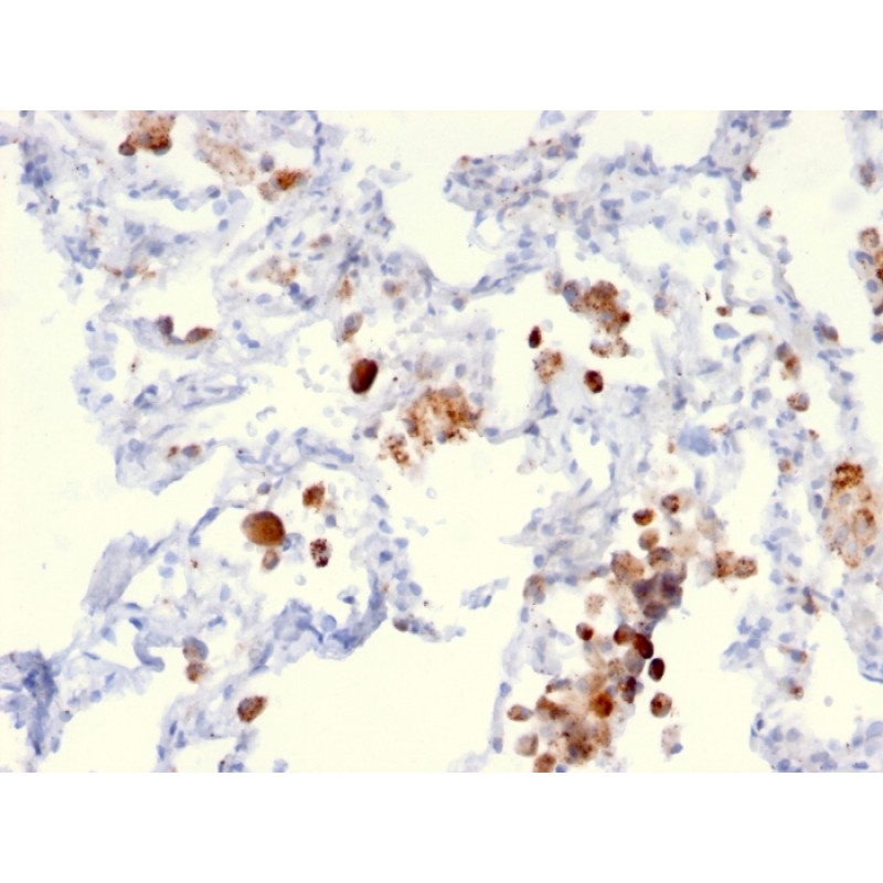 Napsin A (Lung Adenocarcinoma Marker)(NAPSA/3306), CF594 conjugate, 0.1mg/mL