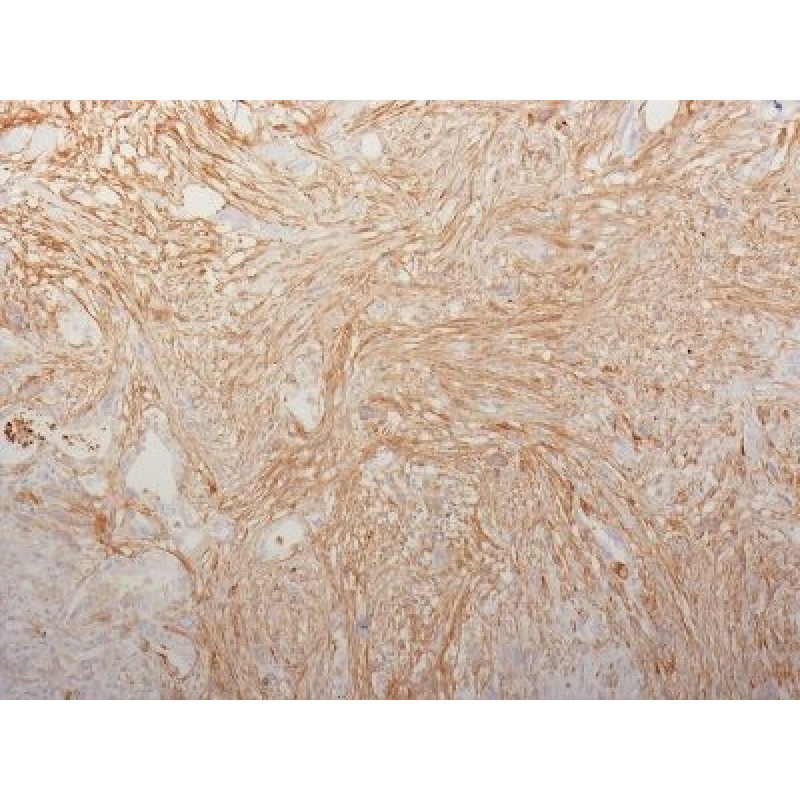 Fibronectin(HFN7.1), Biotin conjugate, 0.1mg/mL