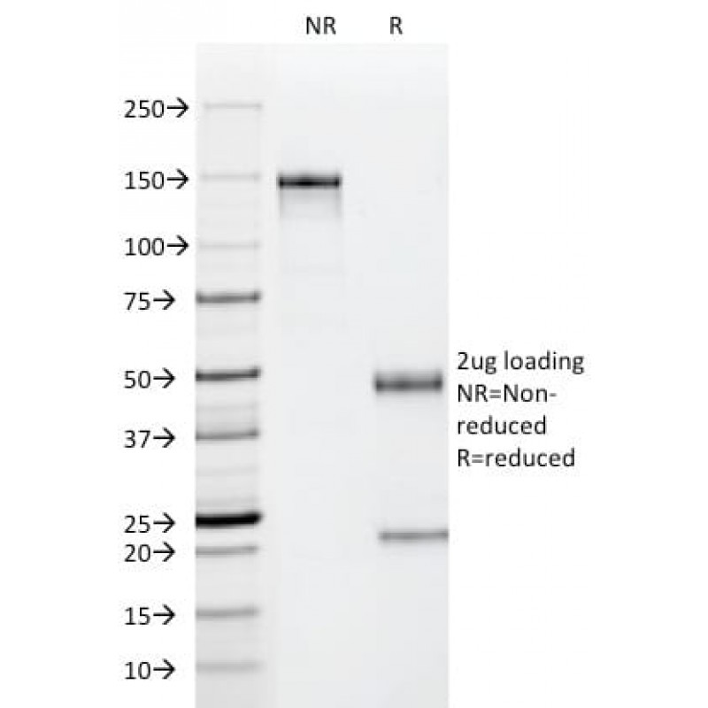 p53(PAb122), Biotin conjugate, 0.1mg/mL
