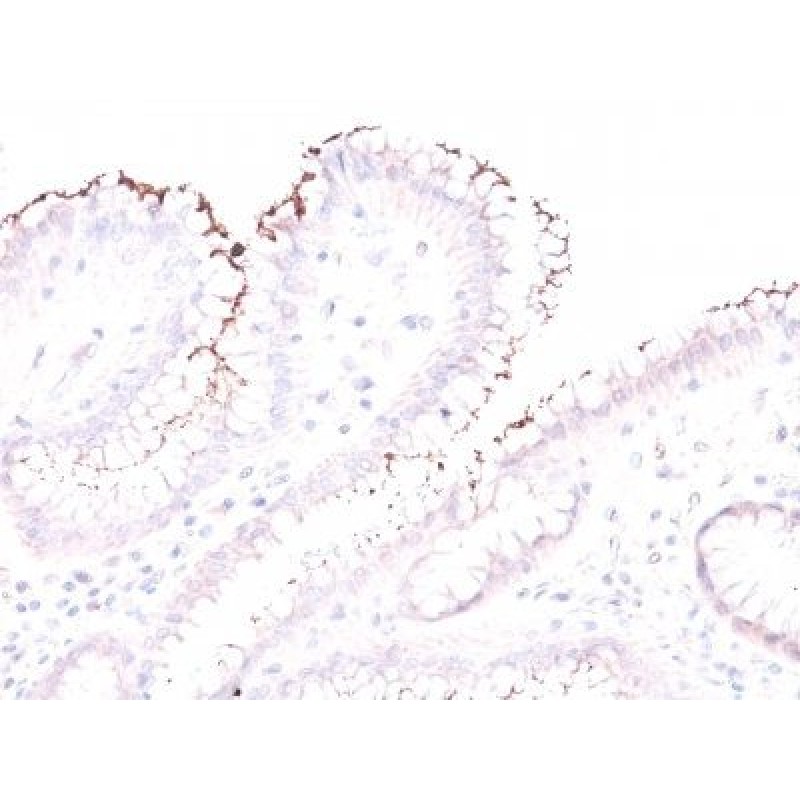 Helicobacter pylori(Rabbit PAb), Biotin conjugate, 0.1mg/mL