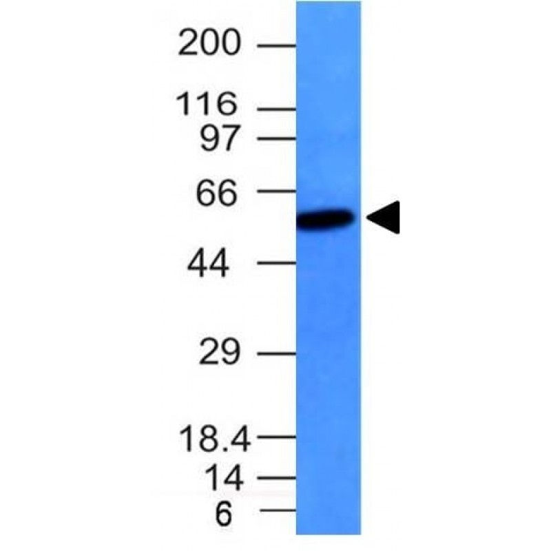 Vimentin(VM452), Biotin conjugate, 0.1mg/mL