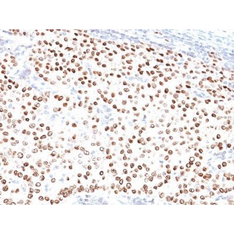 Progesterone Receptor(PR500), Biotin conjugate, 0.1mg/mL