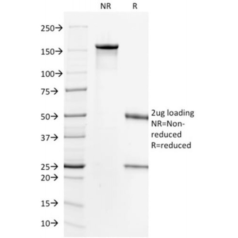 HER-2 / CD340(HRB2/718), Biotin conjugate, 0.1mg/mL