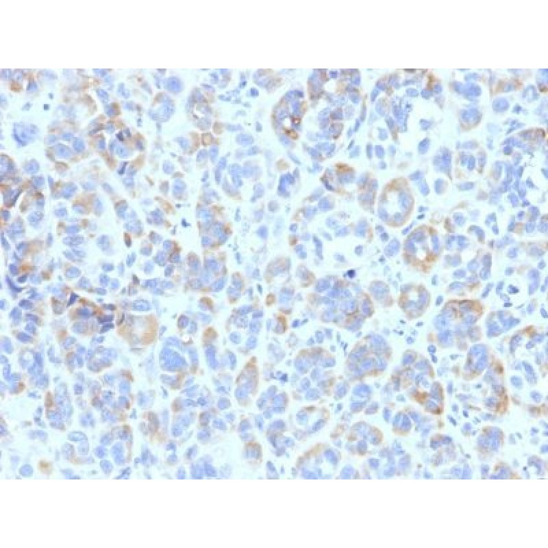 TRP1 (Tyrosinase Related Protein 1)(TYRP1/807), Biotin conjugate, 0.1mg/mL