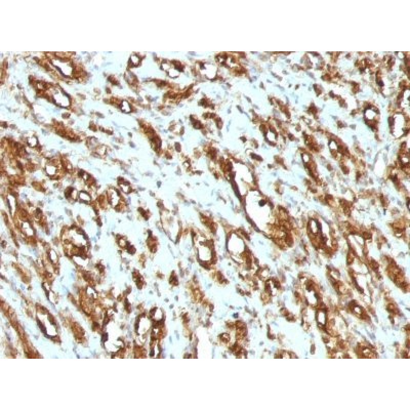 Muscle Specific Actin(MSA/953), Biotin conjugate, 0.1mg/mL