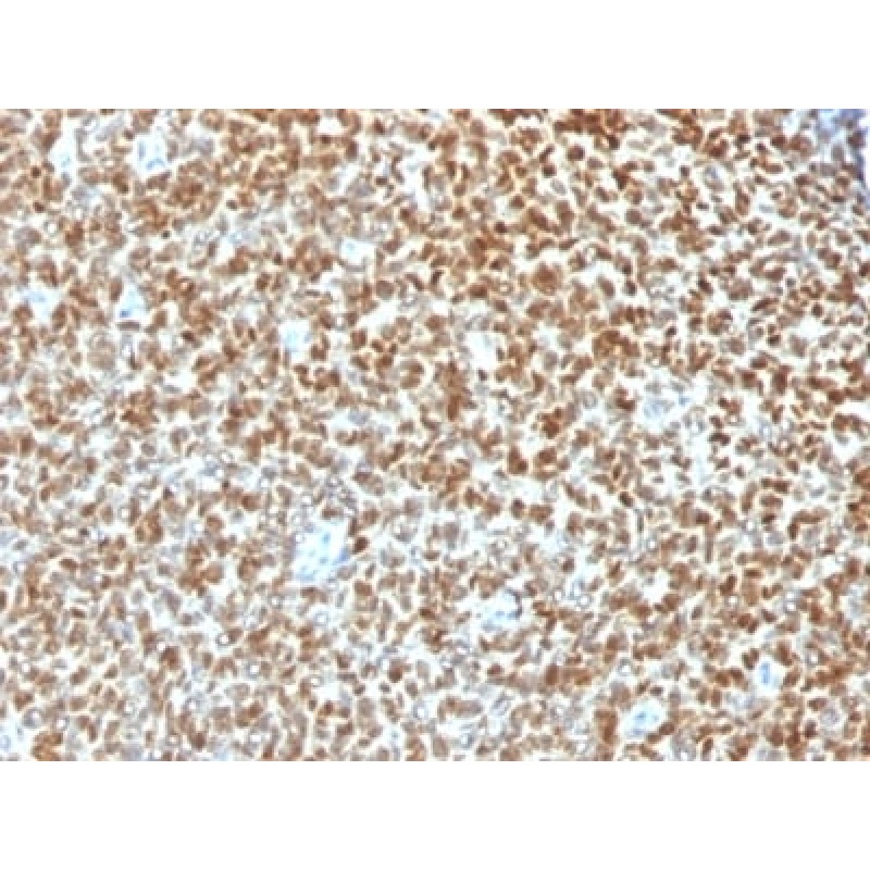 NKX2.2 (Neuroendocrine & Ewing s Sarcoma Marker) (NX2/1422R), Biotin conjugate, 0.1mg/mL