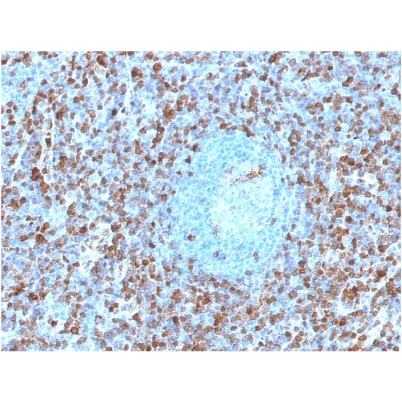 Biotium BNCB1671-100, Annexin A1 / (Hairy Cell Leukemia Marker)(ANXA1/1671), Biotin conjugate, 0.1mg/mL