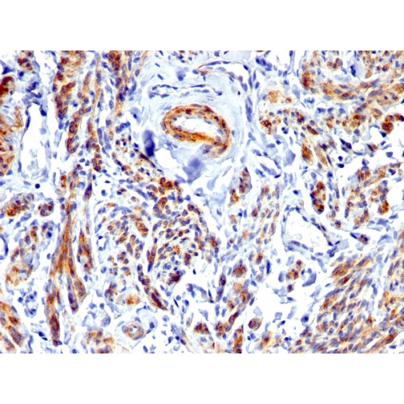 Biotium BNCB1675-100, Caldesmon, HMW (h-Caldesmon) (Smooth Muscle Marker)(), Biotin conjugate, 0.1mg/mL