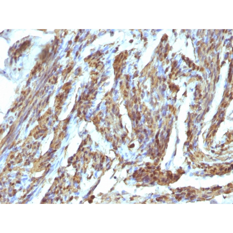 Biotium BNCB1685-500, Calponin-1 (Smooth Muscle Marker)(), Biotin conjugate, 0.1mg/mL