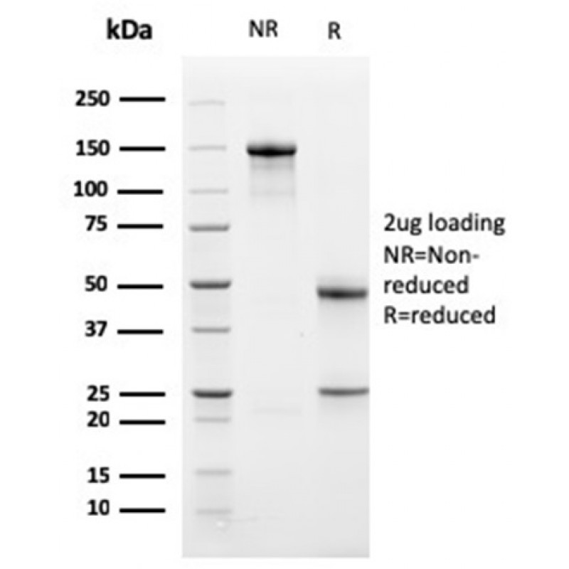 Biotium BNCB1762-100, Bcl-X (Apoptosis Marker)(BCL2L1/1762), Biotin conjugate, 0.1mg/mL
