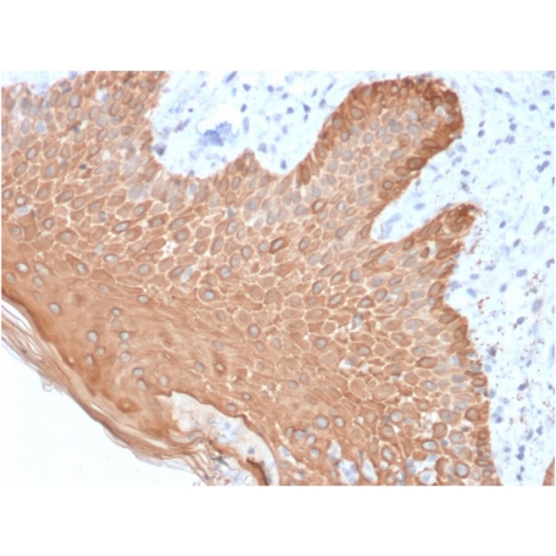 Cytokeratin, Multi (Epithelial Marker)(rKRT/457), Biotin conjugate, 0.1mg/mL